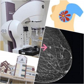 ศูนย์ตรวจแมมโมแกรมโรงพยาบาลพิมาย