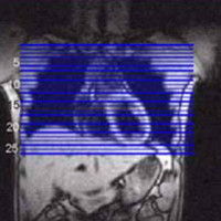 การตรวจปอดและทรวงอก