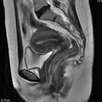 ช่องท้องส่วนล่าง